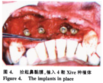 赖红昌