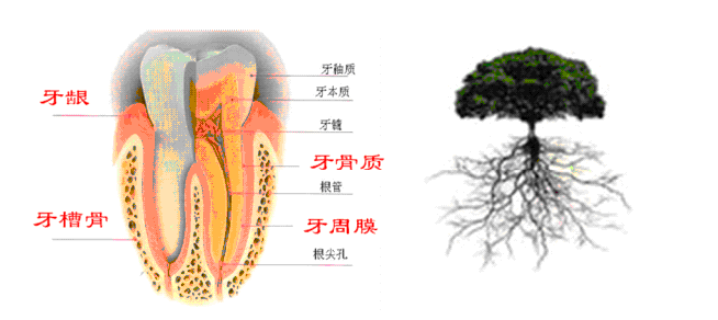 口腔种植