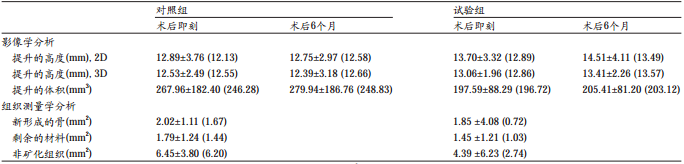 上颌窦提升术