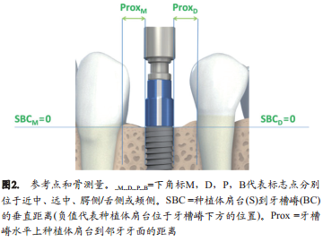 即刻种植(1型)和早期种植(2型)的美学效果、临床效果及以患者为中心的效果