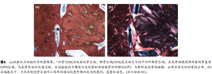 不翻瓣牙槽嵴位点保存术中是否移植异种骨对颊侧骨嵴改建的影响的组织形态学定量分析和显微CT成像研究