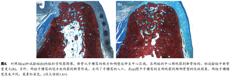 不翻瓣牙槽嵴位点保存术中是否移植异种骨对颊侧骨嵴改建的影响的组织形态学定量分析和显微CT成像研究