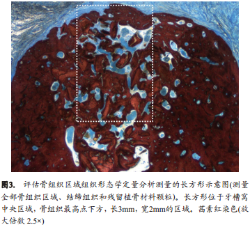 不翻瓣牙槽嵴位点保存术中是否移植异种骨对颊侧骨嵴改建的影响的组织形态学定量分析和显微CT成像研究