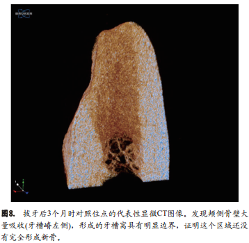 不翻瓣牙槽嵴位点保存术中是否移植异种骨对颊侧骨嵴改建的影响的组织形态学定量分析和显微CT成像研究