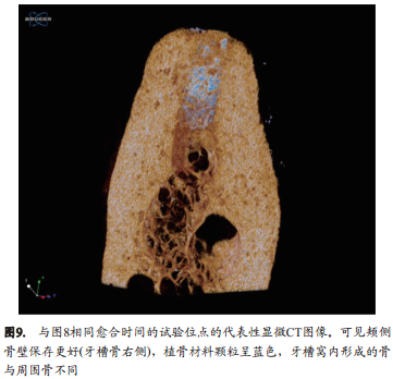 不翻瓣牙槽嵴位点保存术中是否移植异种骨对颊侧骨嵴改建的影响的组织形态学定量分析和显微CT成像研究