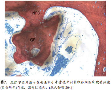 不翻瓣牙槽嵴位点保存术中是否移植异种骨对颊侧骨嵴改建的影响的组织形态学定量分析和显微CT成像研究