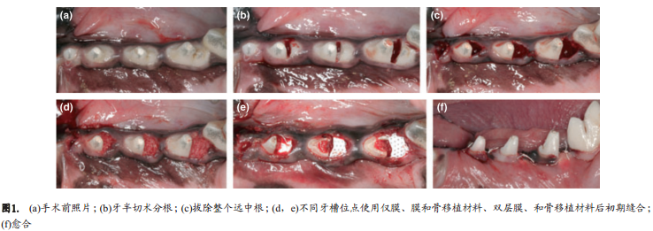 双层膜技术(dPTFE膜置于胶原膜上)应用于拔牙窝位点保存术的效果