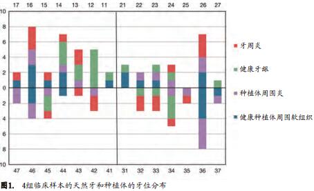 口腔种植