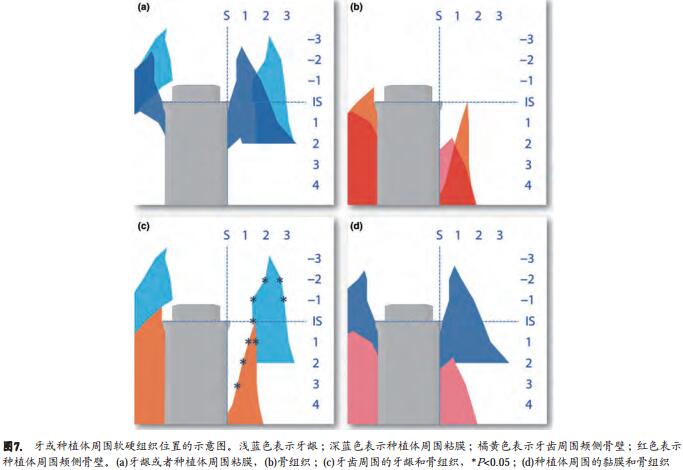 即刻种植同期牙槽嵴保存术的数字化分析