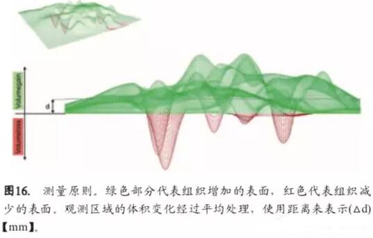 软硬组织增量后种植体周围组织的体积增量及稳定性